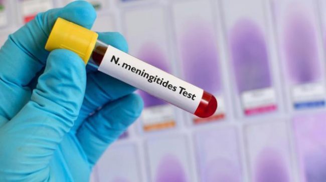 Studentessa universitaria muore di meningite all’età di 19 anni