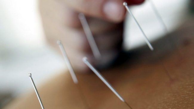 Quando l’agopuntura è abusiva: scoperto falso medico