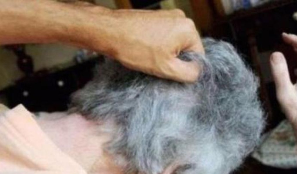 Anziana 85enne picchiata per rubarle la borsa COSA LE HANNO FATTO