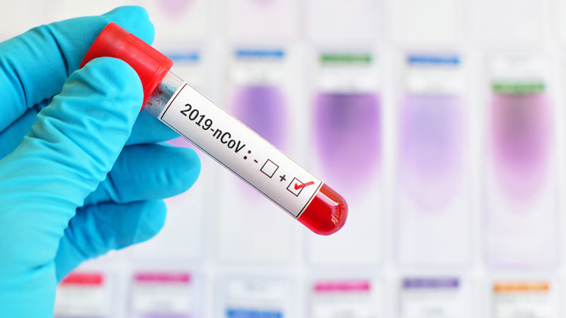 Coronavirus a Cremona e provincia, a che punto siamo?