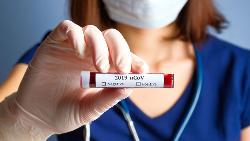 Coronavirus, test sierologici: oggi al via in provincia di Cremona