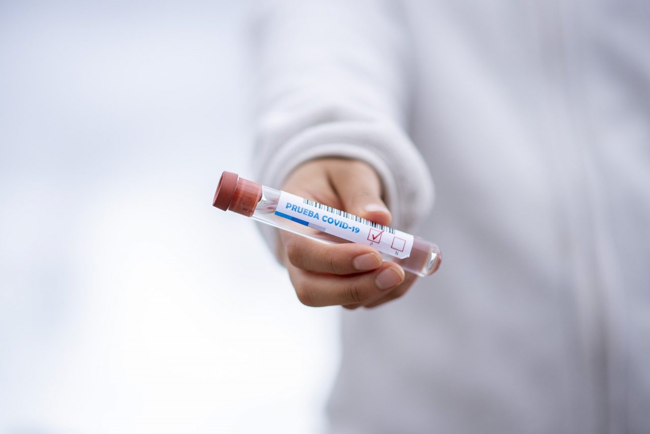 Coronavirus, gli ultimi aggiornamenti da Regione: a Cremona e provincia 6.374 positivi (+9)