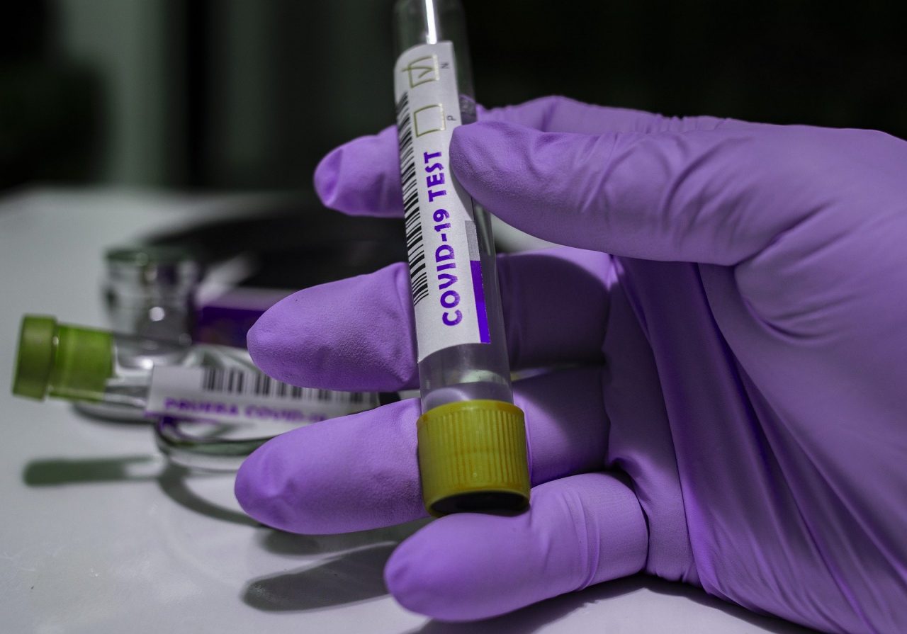 Nuovo test sierologico: economico, affidabile e facilmente eseguibile dai laboratori di ricerca