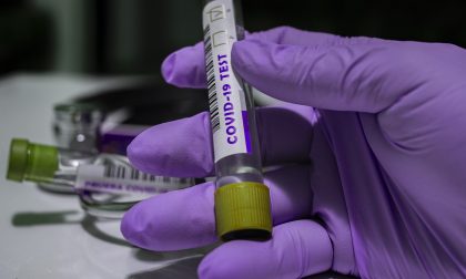 Nuovo test sierologico: economico, affidabile e facilmente eseguibile dai laboratori di ricerca