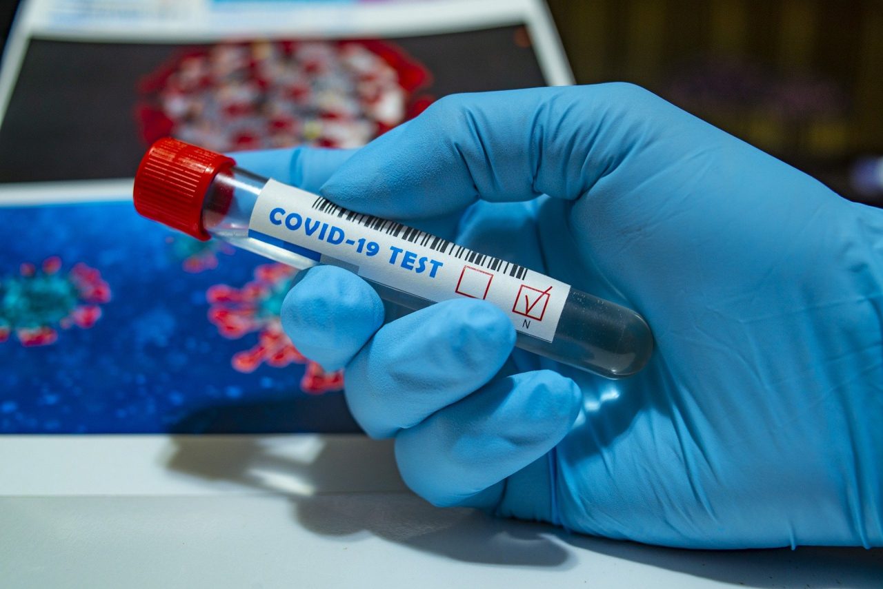 Coronavirus: cosa significa “debolmente positivi”? C’è da preoccuparsi?