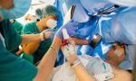 Dopo l'emergenza Covid, primo intervento di chirurgia da sveglio: il paziente disegna in sala operatoria