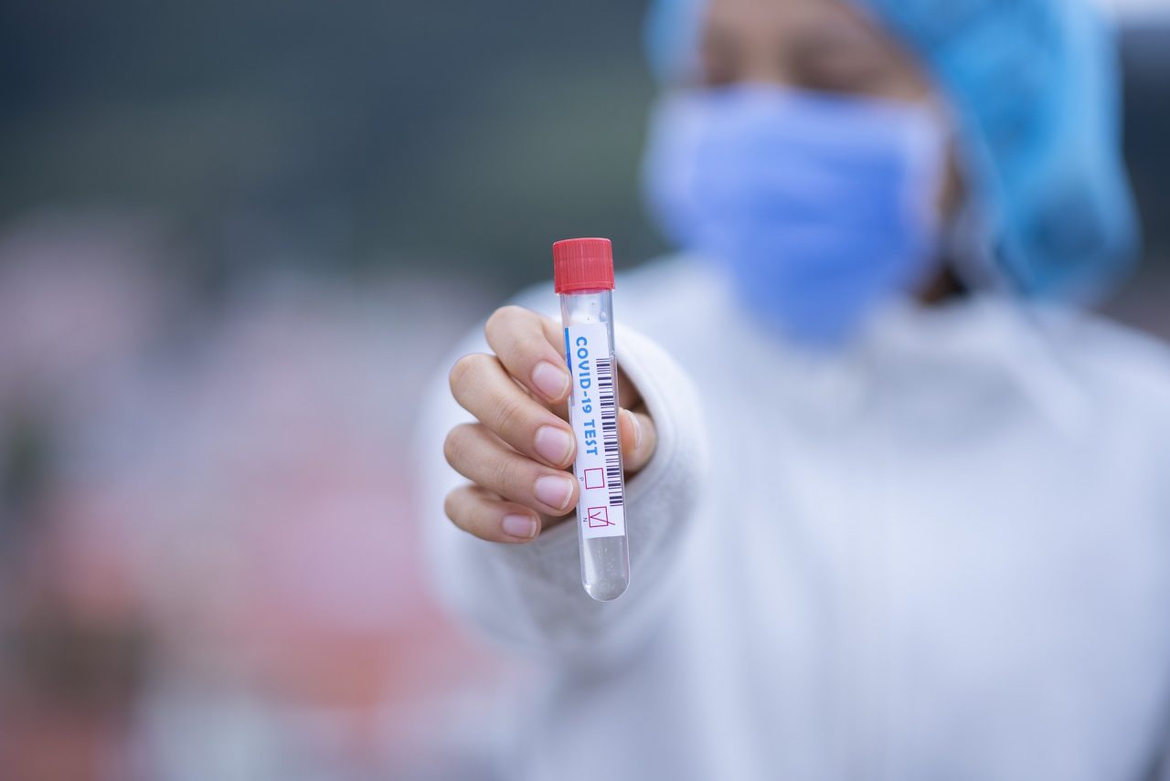 Coronavirus: in Lombardia 187 nuovi positivi, 3 sono cremonesi