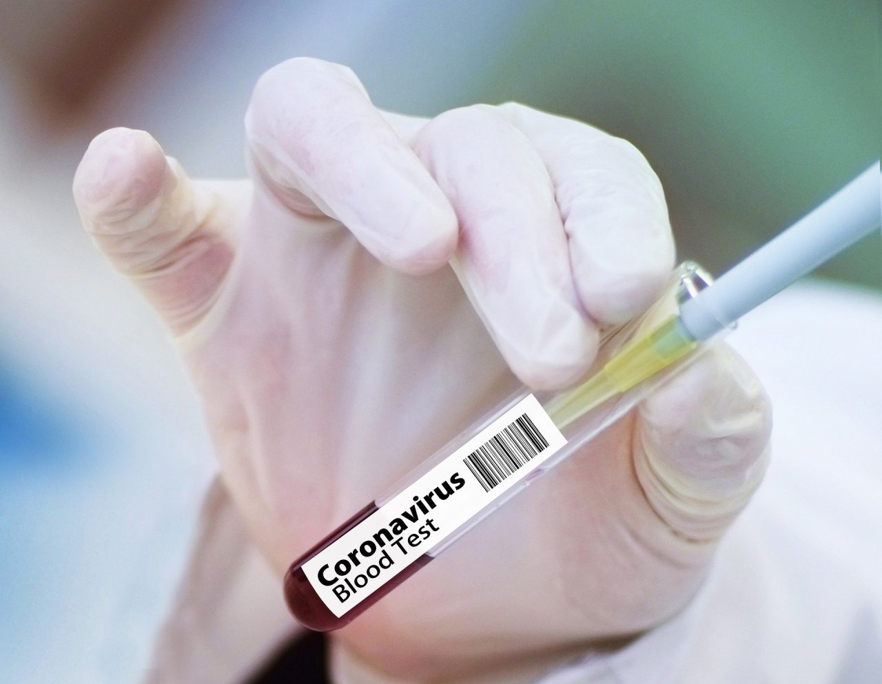 Si ai test sierologici nei laboratori privati: gli accreditati a Cremona e provincia