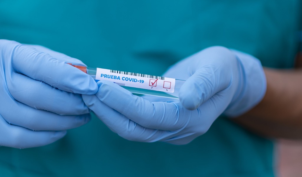 Coronavirus, in Lombardia 259 nuovi positivi: a Cremona e provincia sono 6.556 (+2)