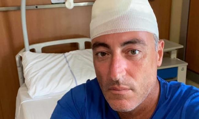 Assessore Gallera ferito mentre gioca a paddle, 30 punti in testa