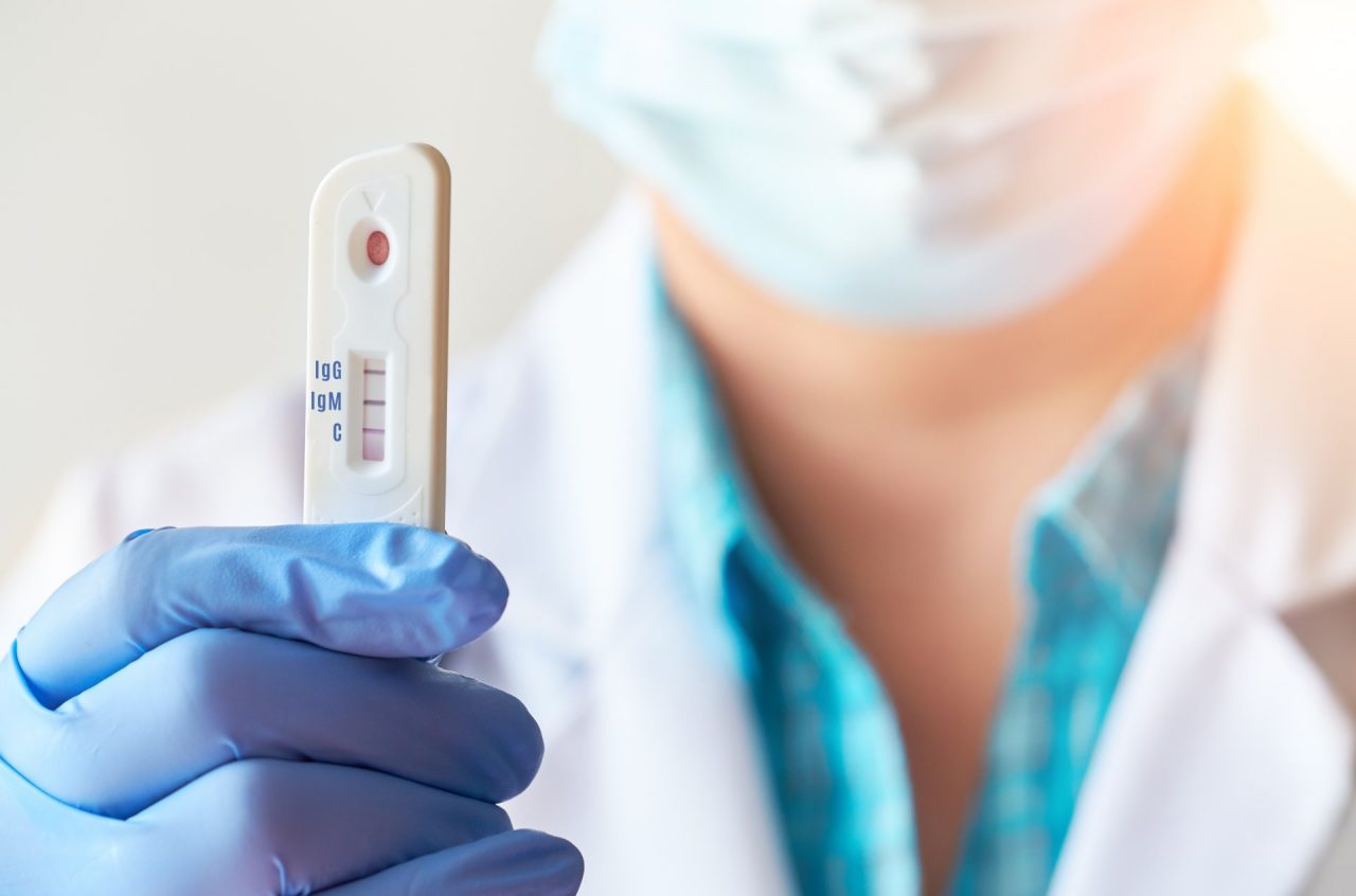 Da lunedì in Lombardia tamponi rapidi (anche nelle scuole) per individuare il Covid