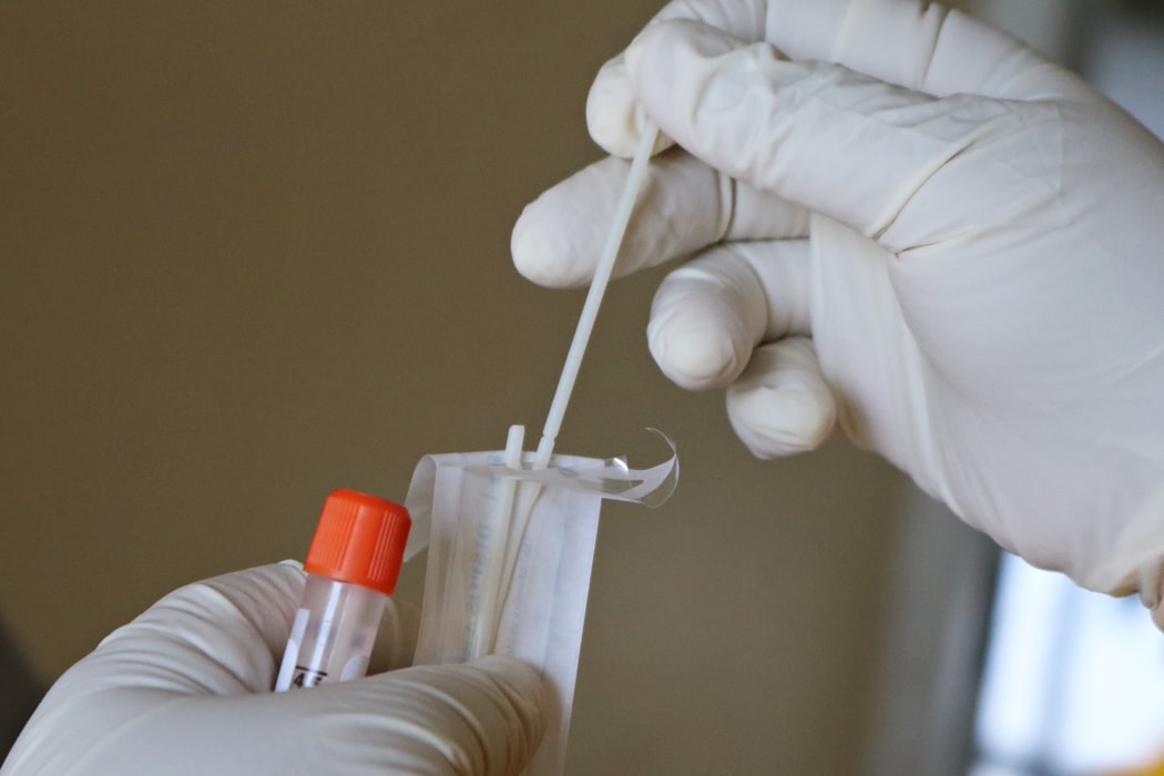Tamponi rapidi antigenici, ora anche i medici di base potranno effettuarli