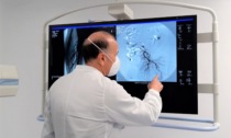 Donato all'Ospedale di Cremona un nuovo angiografo di ultima generazione
