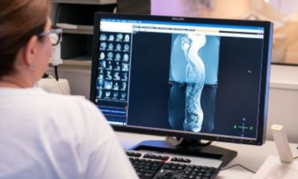 Radiologia: anche a settembre visite nel fine settimana e in notturna. Come prenotare