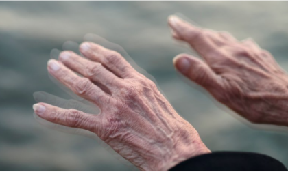 Giornata Nazionale della Malattia di Parkinson: a Crema due eventi per sensibilizzare