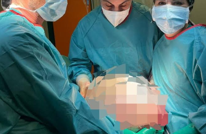 Le foto dell’operazione record all’ospedale di Crema: rimosso un tumore di 30 chili alle ovaie
