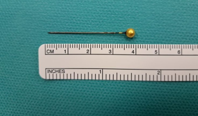 Sarta ingoia uno spillo di 4 centimetri che le si conficca nel polmone destro