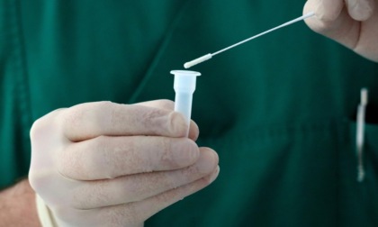 Fast Track City, a Cremona test salivari gratuiti (e anonimi) per HIV e HCV