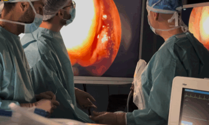 17enne operata per meningocele: intervento riuscito con tecnica endoscopica